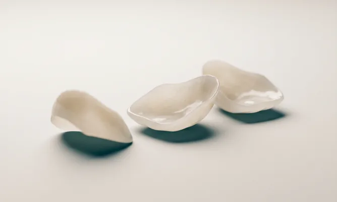 Tres carillas de porcelana ultrafinas