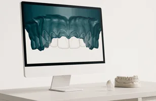 Diseño digital de la sonrisa en pantalla